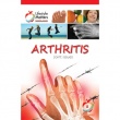 Arthritis - Pocket Books