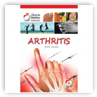 Arthritis - Pocket Books